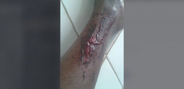 Zac Mbao: Un émigré mord son fils jusqu'au sang (photo)