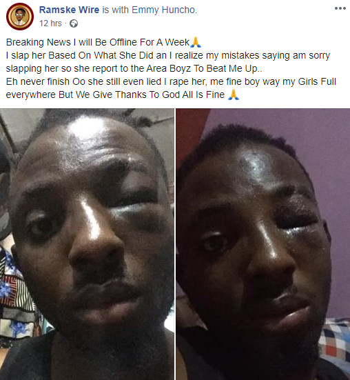 Nigéria: Une femme embauche des hommes pour tabasser son petit ami Nigéria: Une femme embauche des hommes pour tabasser son petit ami