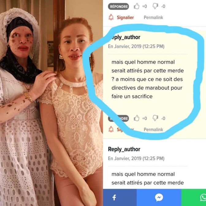 Commentaire injurieux sur les femmes albinos, Ma Keïta se fâche et menace