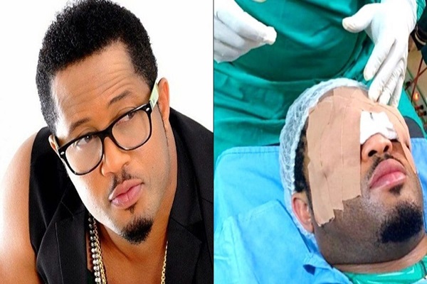 L’acteur nigérian Mike Ezuruonye a subi une chirurgie des yeux (photo)