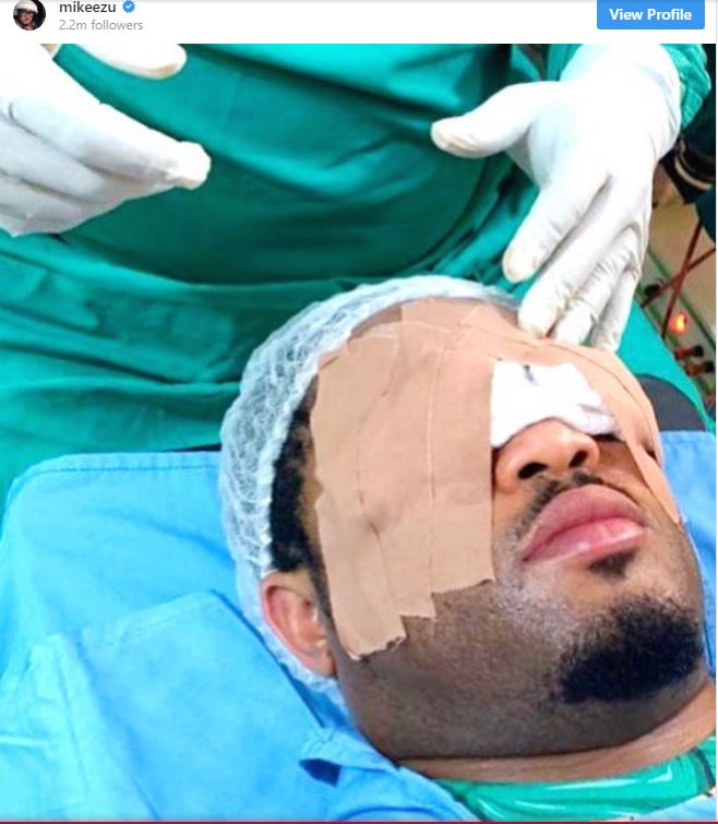 L’acteur nigérian Mike Ezuruonye a subi une chirurgie des yeux (photo)