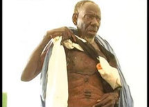 Touba : Babacar Mbaye Diouf atteint d’une maladie mystérieuse :« des bestioles sortent de mon corps »