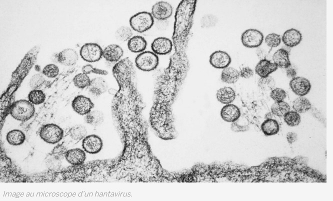 Non, un hantavirus ne va pas déclencher une nouvelle épidémie