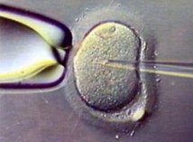 Santé : 5 millions de bébés nés par fécondation in vitro depuis 1978