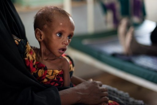 Clôture d’une formation sur la malnutrition sévère aigue, samedi à Thiès
