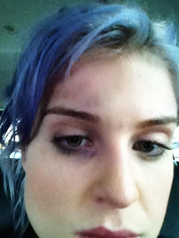 Photo : Kelly Osbourne et son oeil au beurre noir