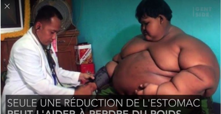 L'enfant qui pesait 190 kilos s'est métamorphosé