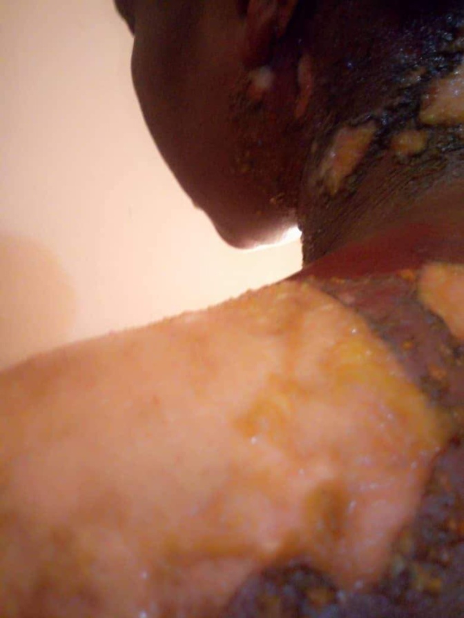 VIDEO - Diakhaye: Une femme verse du thé chaud sur sa coépouse