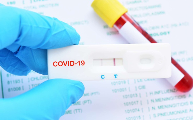 Covid-19 / Fatick: Un homme de 70 ans testé positif porte les cas à 33