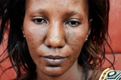 Paroles de réfugiés mauritaniens : à Dakar, sans espoir de retour