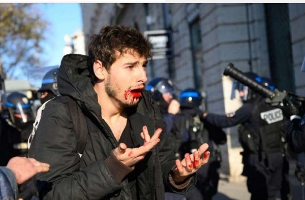 Violences policières à Lyon (France) : deux agents renvoyés en correctionnelle pour avoir frappé un manifestant