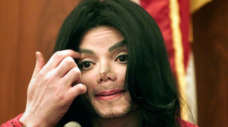 « Des blessures terribles » L’autopsie de Michael Jackson révèle les douleurs dont a souffert le chanteur