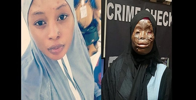 Arabie Saoudite: Une Ghanéenne victime d’une attaque à l’acide