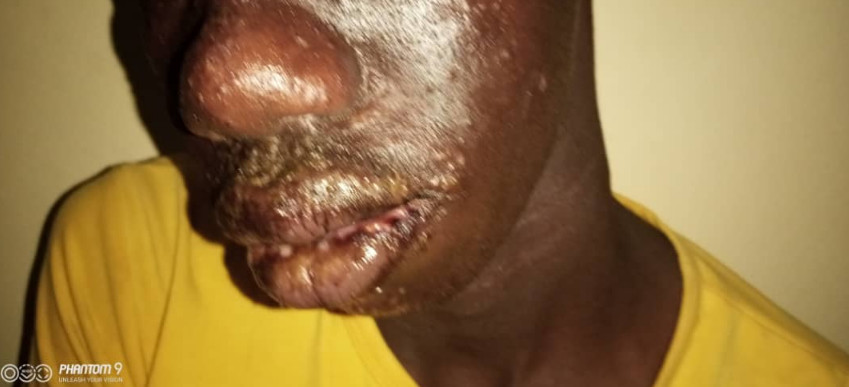 Thiaroye-Sur-Mer: une mystérieuse maladie sème le trouble dans la localité (âmes sensibles s'abstenir) Thiaroye-Sur-Mer: une mystérieuse maladie sème le trouble dans la localité (âmes sensibles s'abstenir)