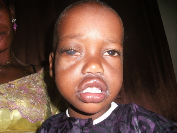 Lii Doy Na Waar du vendredi 15 mars 2013: Bébé Omar opéré avec succès 