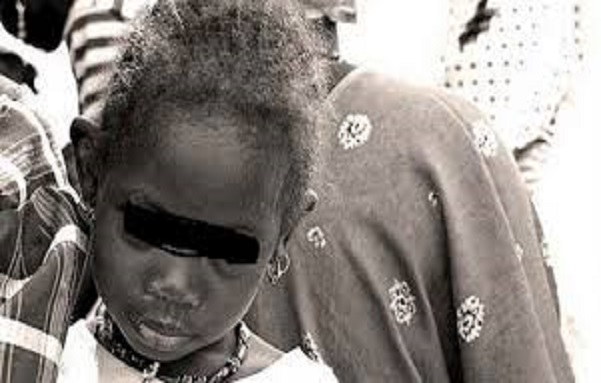 Scandale sexuel à Guinaw Rails Sud: L’oncle E. M. D. abusait de sa nièce de 03 ans 