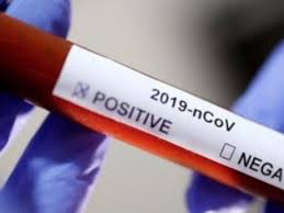 Covid-19: Le prix des tests rapides divisé par deux pour les pays en développement