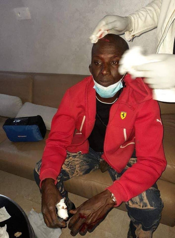 Manifestations chez Ousmane Sonko: Assane Diouf parmi les blessés (Photos)
