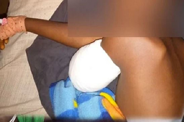 Manifestations de soutien à Ousmane Sonko: L’élève amputé du bras est sorti de l’hôpital