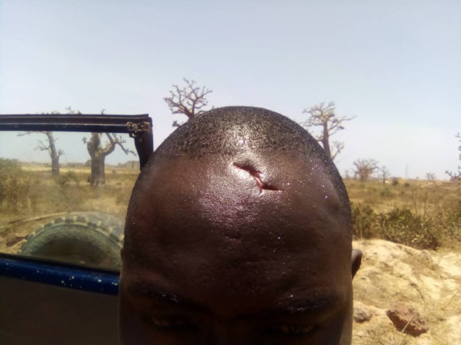 Violentes manifestations à Dougar: Ce type de projectiles désormais prisés par les sénégalais (photos)