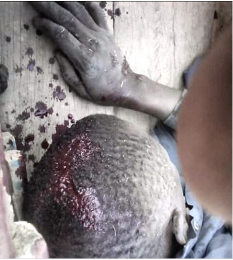 Affrontements à Ndingler: Des blessés entre les paysans et la sécurité de Babacar Ngom, enregistrés