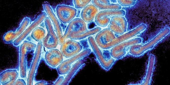 Maladie à virus de Marburg: Un premier cas confirmé en Guinée