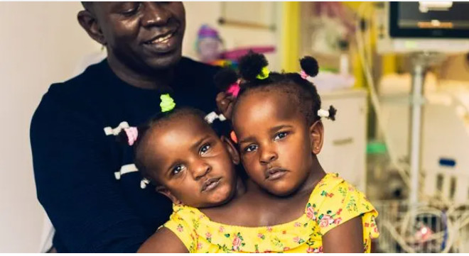 Les siamoises Sénégalaises Ndèye et Marème marchent pour la première fois