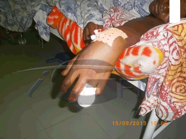 (Photos + Vidéos) Battue à coup de machette par son mari, Awa Dagnokho est sortie de l’hôpital