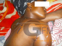 Khady Kama tailladée à coups de machette par son mari, la Lsdh et Amnesty Sénégal entrent dans la danse