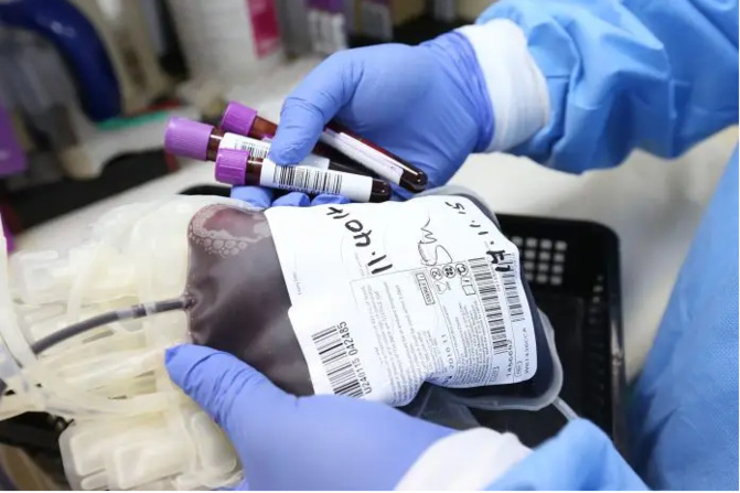 Hépatite B: 10% de la population sénégalaise infectés