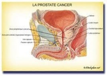 795 femmes meurent du cancer de l’utérus par an au Sénégal