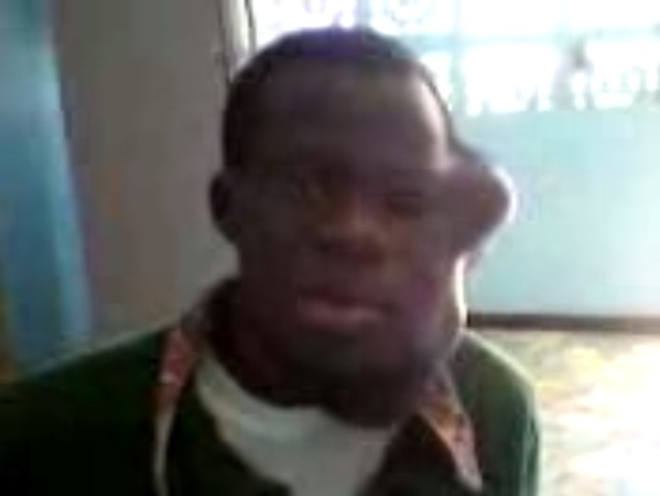 Vidéo - "Leral Aide et Action" : Après une bagarre, Abdoulaye Djimbira se retrouve avec un visage défiguré et un cou boursouflé Vidéo - "Leral Aide et Action" : Après une bagarre, Abdoulaye Djimbira se retrouve avec un visage défiguré et un cou boursouflé
