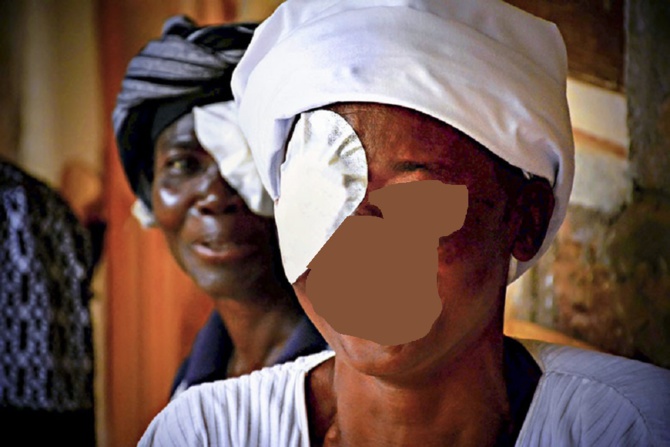 Coups et blessures volontaires : L’employé de pâtisserie Cheikh Fall éborgne sa collègue de travail et prend un an ferme