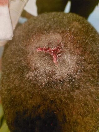 Photos / Convoi de Ousmane Sonko attaqué : Les images de l’agression publiées