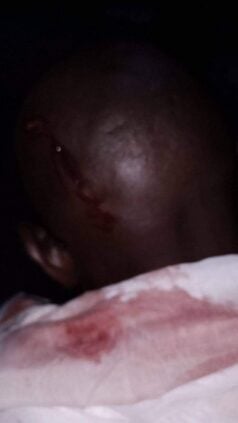 Photos / Convoi de Ousmane Sonko attaqué : Les images de l’agression publiées
