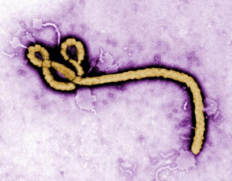 Un sérum secret contre le virus Ebola ?