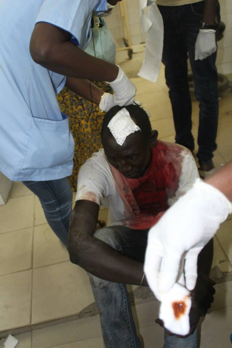 Photos - Répression de la manifestation des étudiants: Le sang a coulé à l'UCAD