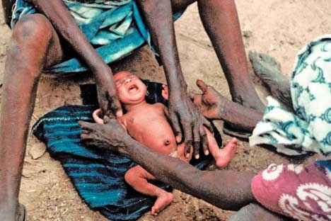 Excision : Une pratique qui tend à disparaître mais encore présente au Sénégal