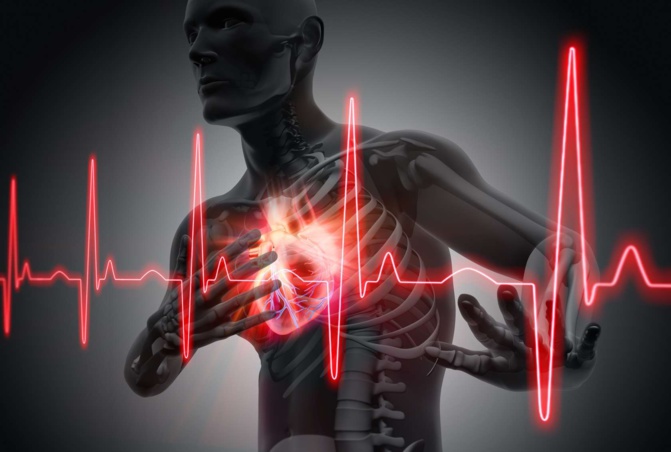Santé : IL faut 1 à 2 millions pour un seul traitement d’une crise cardIaque…