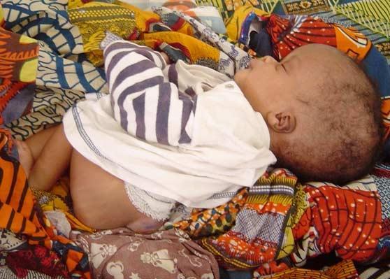 Kolda : La mineure pratique l'amour à outrance, se fait engrosser, accouche et jette son bébé