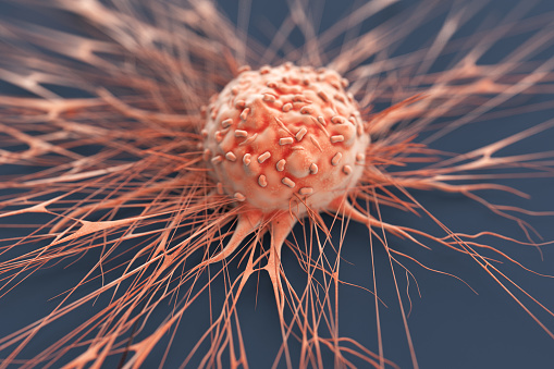 Cancer : 8 mille personnes tuées par an au Sénégal Cancer : 8 mille personnes tuées par an au Sénégal