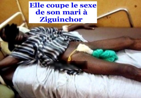 Ziguinchor : Une jeune mariée sectionne le sexe de son époux
