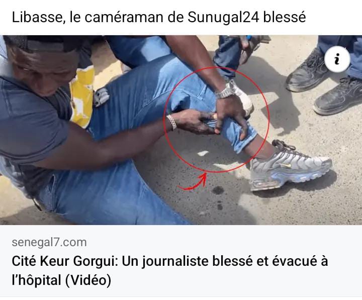 Photo / Cité Keur Gorgui : Un cameraman de Sunugal 24 blessé et évacué à l’hôpital