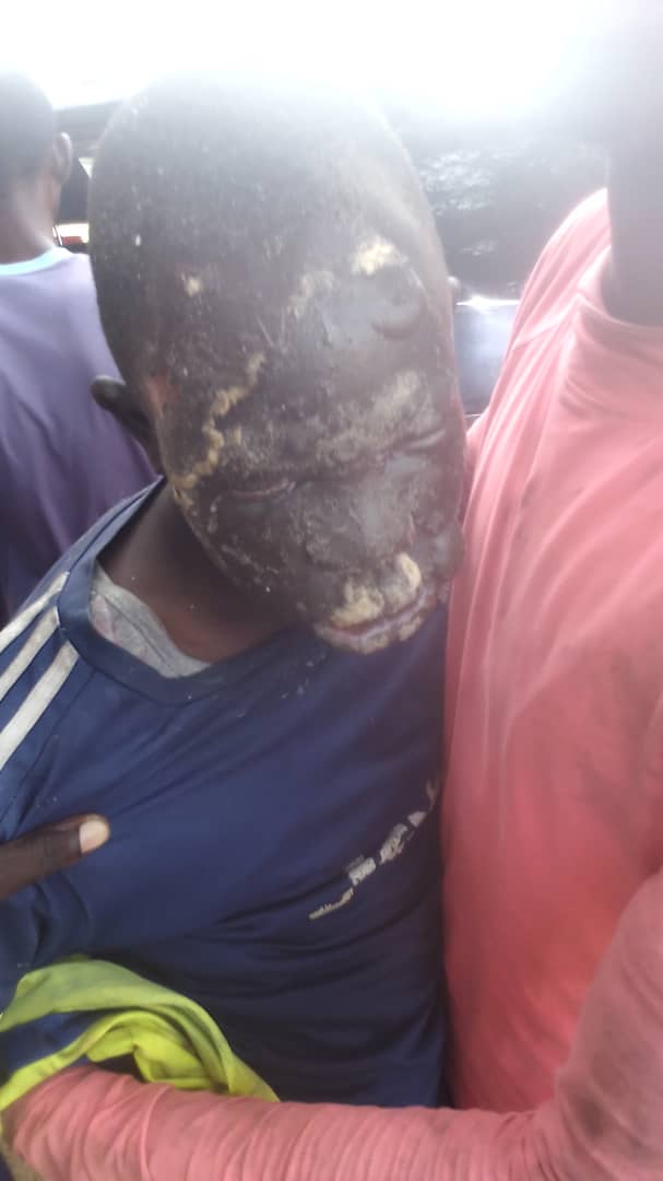 Photos-Video/ Affrontements entre pêcheurs de Cayar et Mboro: Plusieurs blessés enregistrés Photos-Video/ Affrontements entre pêcheurs de Cayar et Mboro: Plusieurs blessés enregistrés