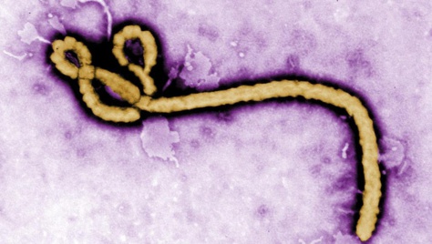 Alerte: Un échantillon de virus Ebola volé en Guinée