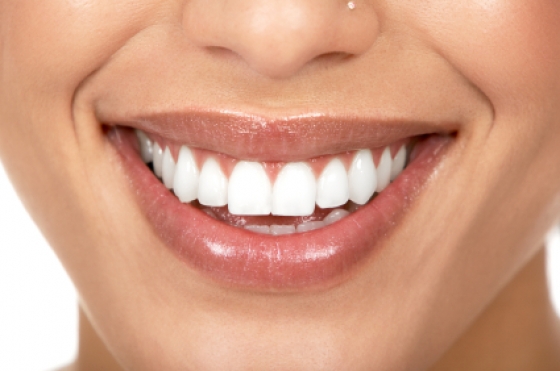 5 choses incroyables capables de vous donner des caries