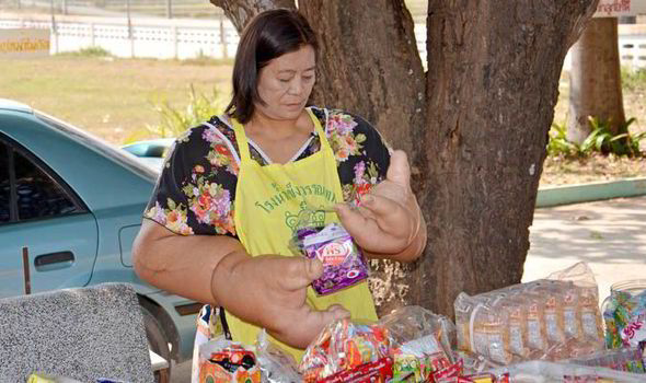 Duangjay Samaksamam a les plus grandes mains du monde