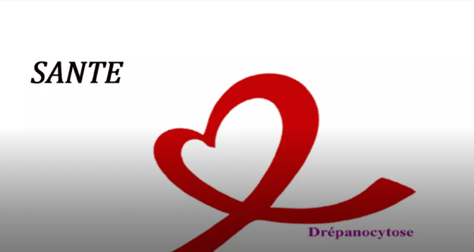 Drépanocytose : Environ 2.000 enfants naissent chaque année avec la maladie