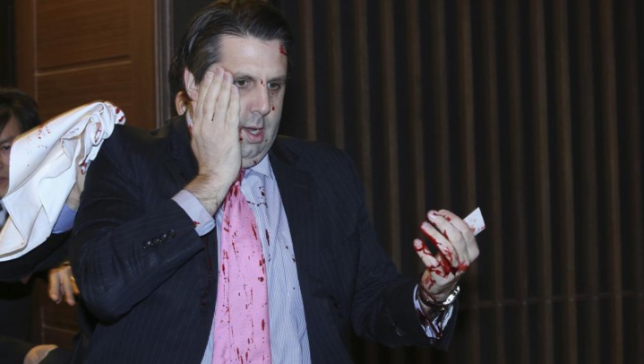 L'ambassadeur américain à Séoul blessé dans une attaque au couteau