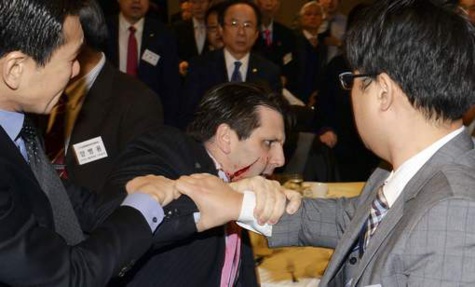 Attaque de l'ambassadeur US en Corée du Sud, il l'a bien mérité, selon Pyongyang